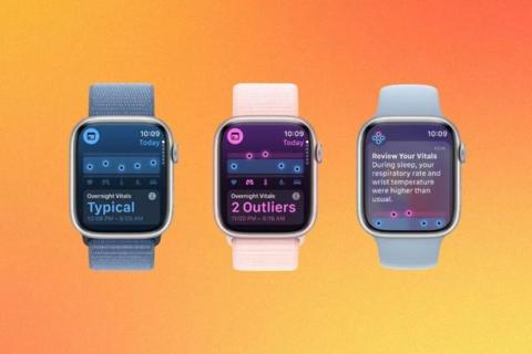 من iPhoneIslam.com، تعرض ثلاث ساعات ذكية، بما في ذلك واحدة تتميز بنظام watchOS 11 وأخرى من Garmin، نتائج مختلفة لدراسة النوم مع أساور معصم ملونة مختلفة على خلفية برتقالية متدرجة.